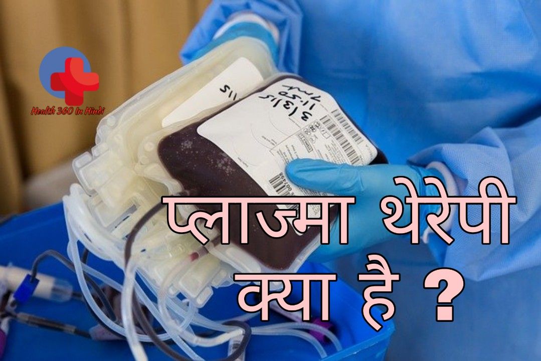 plasma therapy in hindi