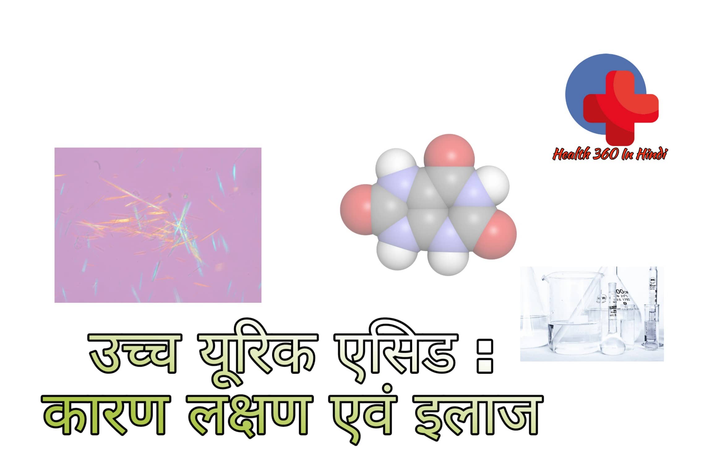 Uric Acid in Hindi
