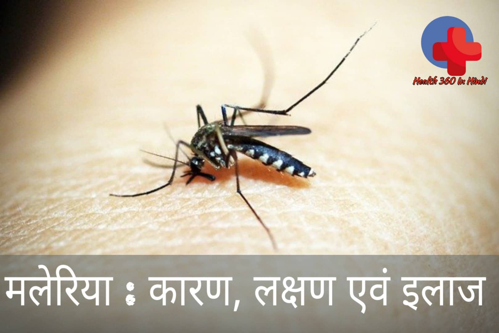Malaria in Hindi