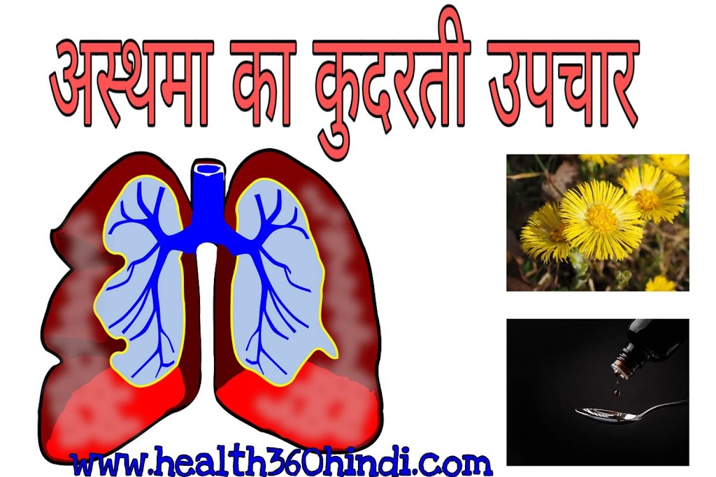 Asthma Home Remedies in Hindi