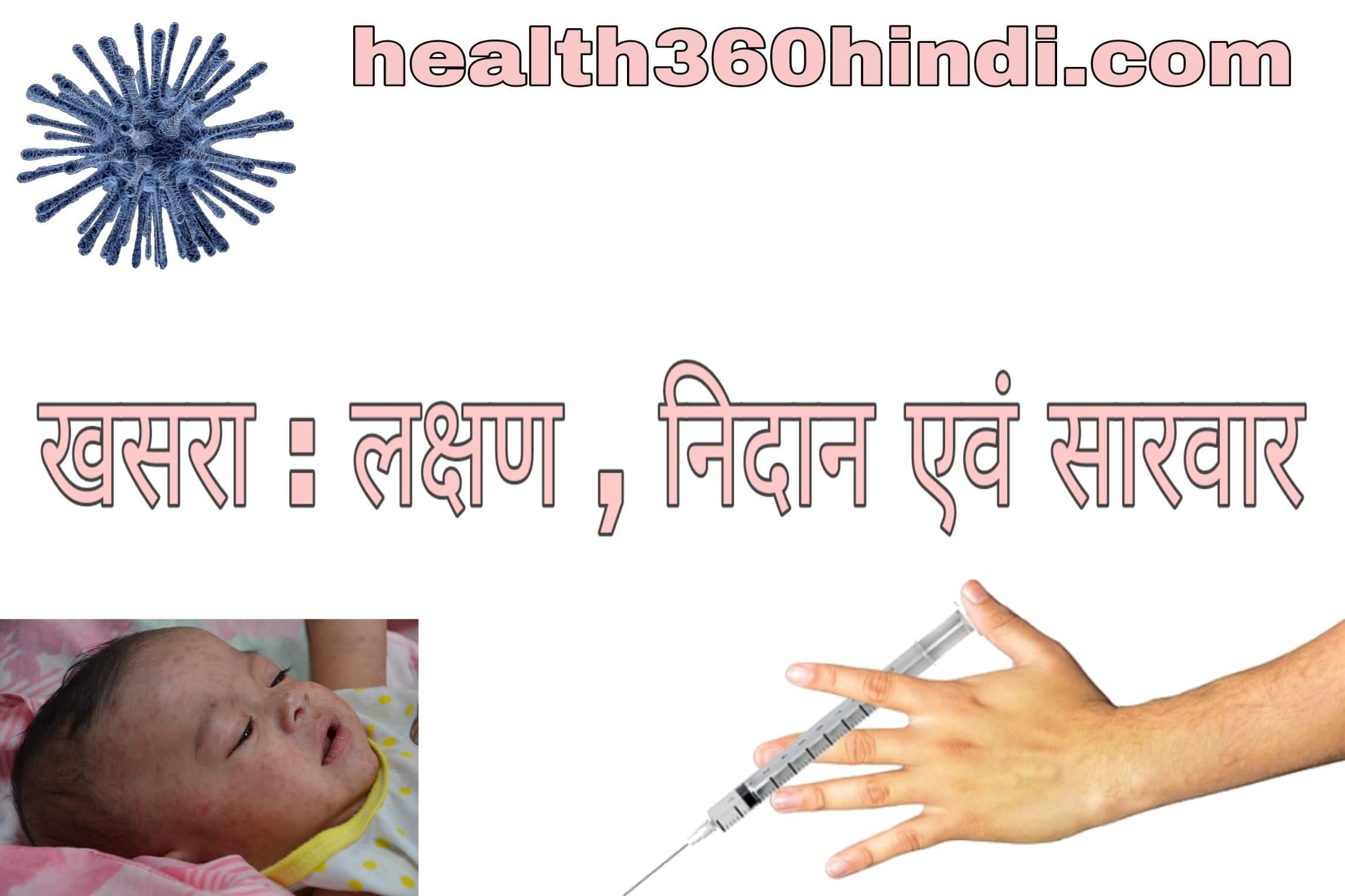 Measles in Hindi