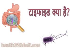 Typhoid in Hindi
