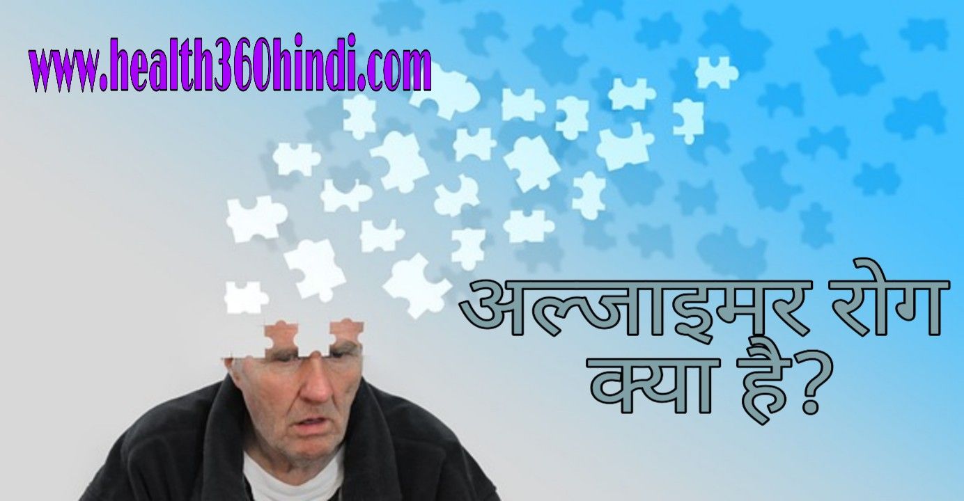 Alzheimer’s Disease in Hindi