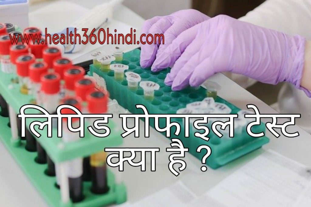 Lipid profile test in Hindi