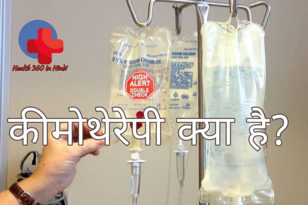Chemotherapy in Hindi