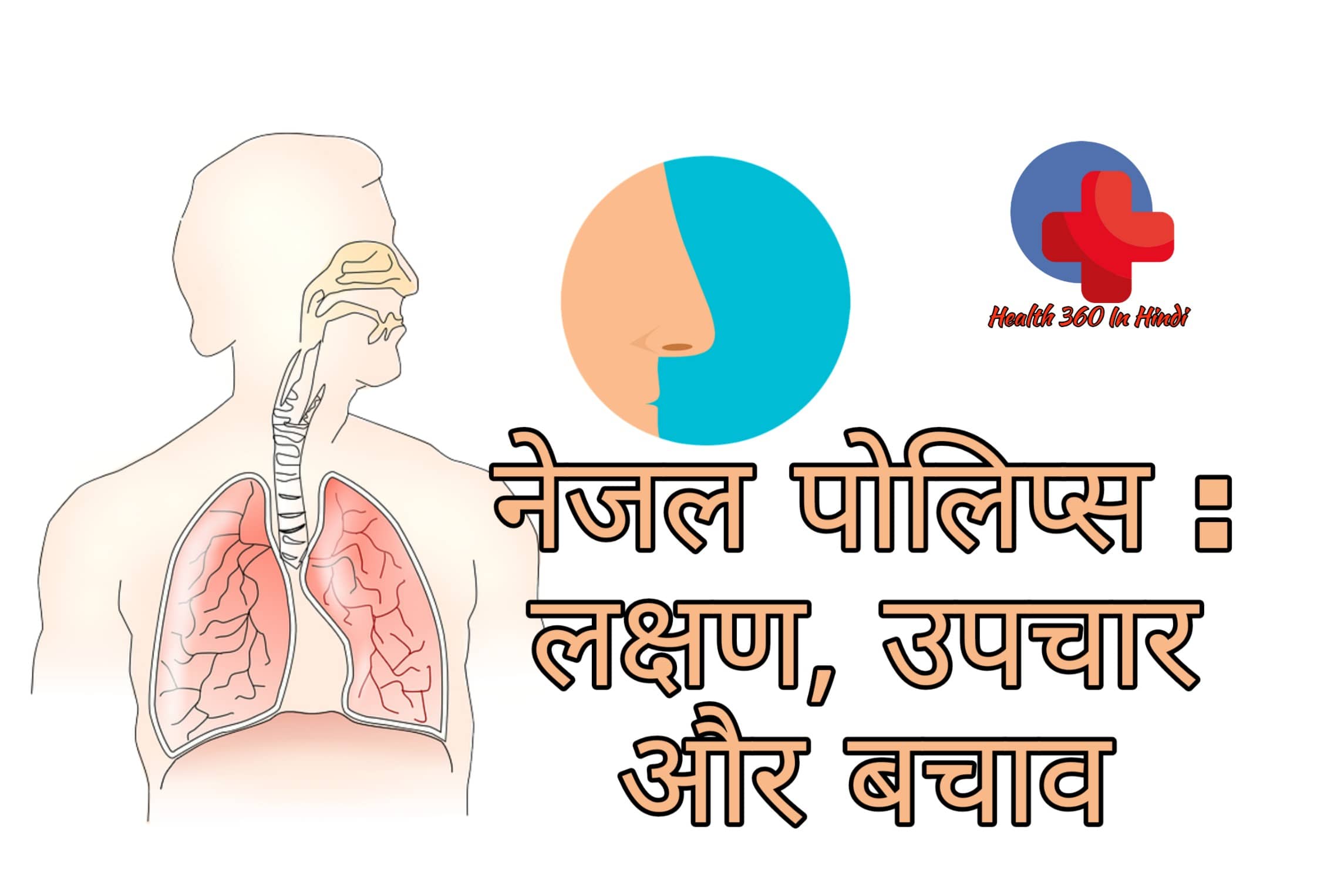 Nasal Polyps in Hindi