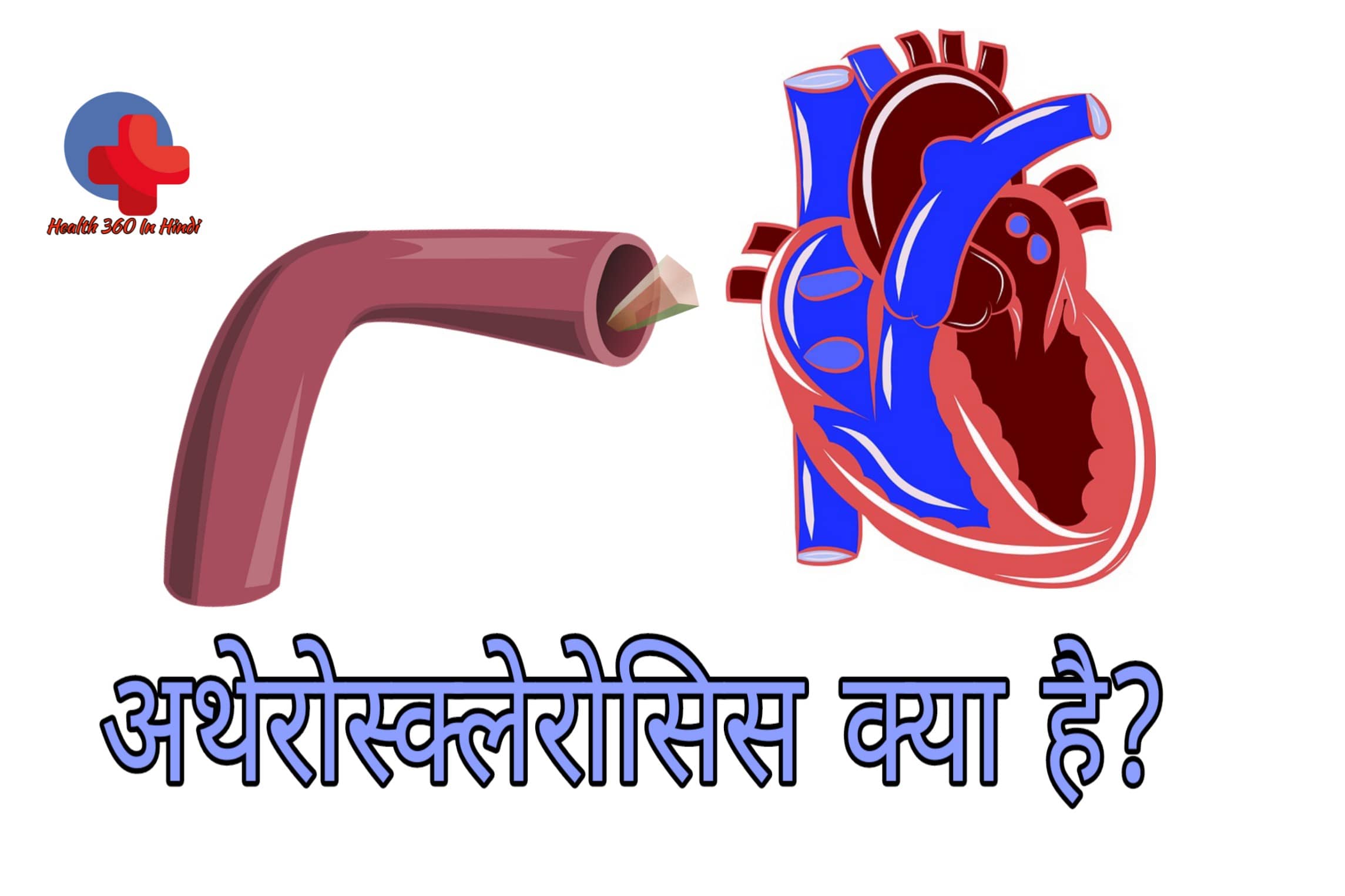 Atherosclerosis meaning in Hindi