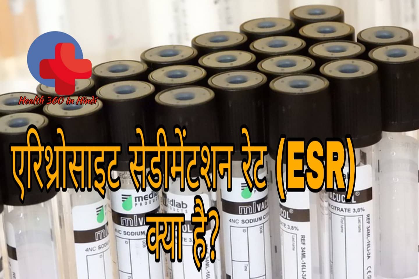 ESR Test in Hindi