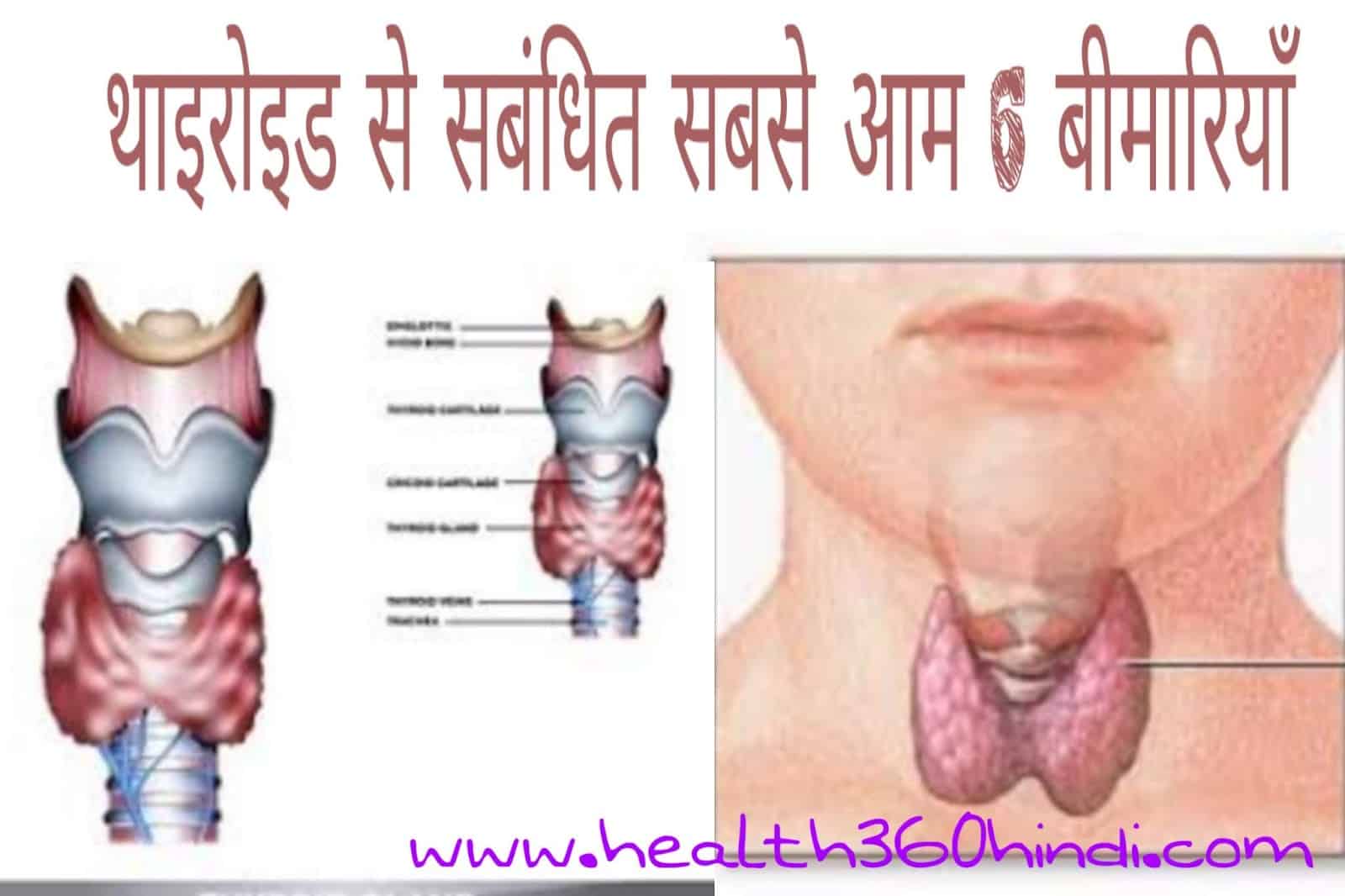 Thyroid Disease in Hindi