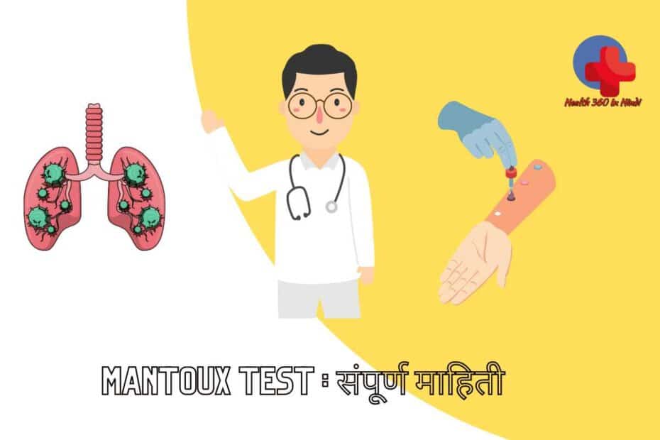 Mantoux test in Hindi